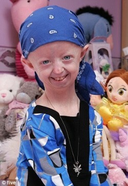 everydaywithpewdiepie:  If you guys don’t know who this amazing girl is, her name is Hayley Okines.  I’ve been following Hayley’s journey for over two years, since I saw her documentary on YouTube. Hayley had a rare disease called “Progeria”