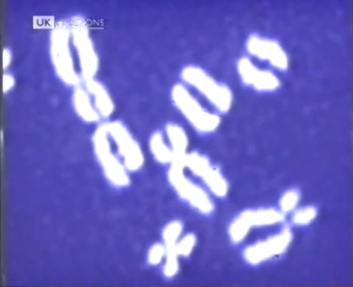 vastderp:Abnormal chromosome samples taken from Chernobyl’s post-disaster cleanup crew.A team of sci