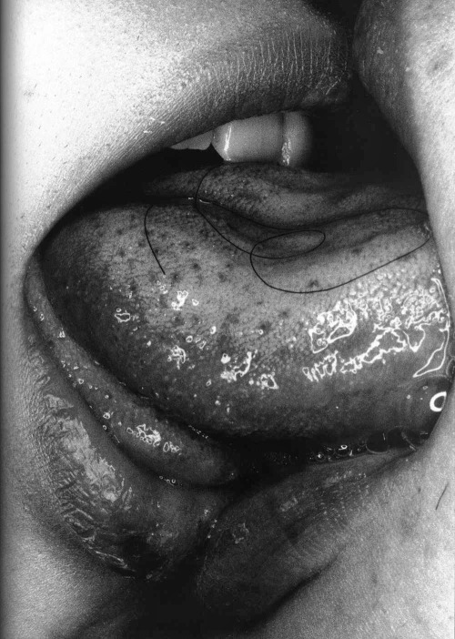 Nobuyoshi Arākī  荒木经惟 aka Arākī アラーキー aka Tensai Araki (Japanese, b. 1940, Tokyo, Japan) - From Erot