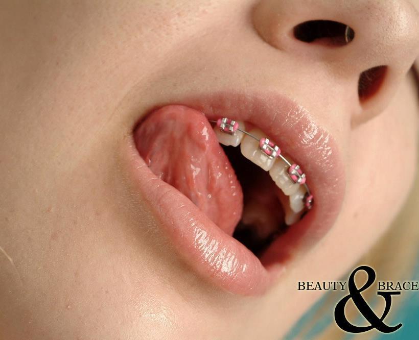 bizarreeyoral: