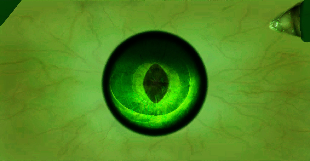 my-little-skyrim-corner-new-blood-elf-eye-textures-using-the-2nd-one
