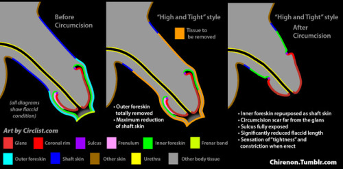 snippykins: circcity-bareheadnation: jzeqm23: tightlycut: ourmalcirc: chirenon: Four Circumcision Ty