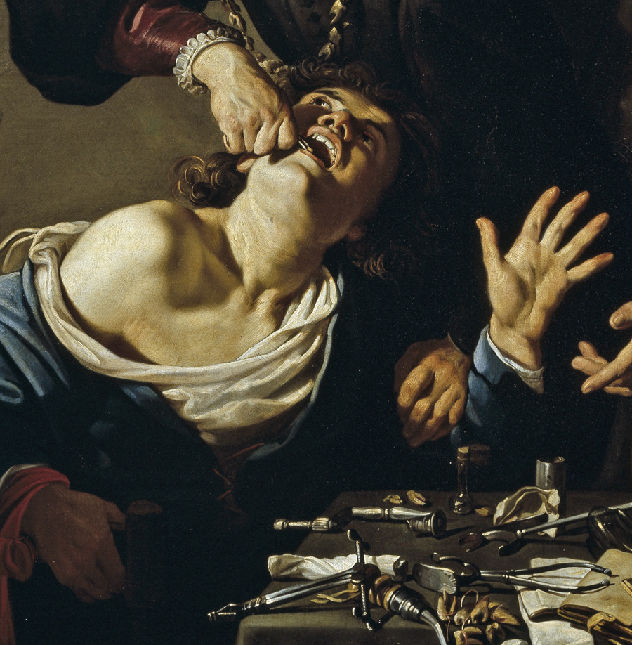 caravaggista:   The Tooth Puller: Caravaggio (attributed, c. 1609?), Theodoor Rombouts