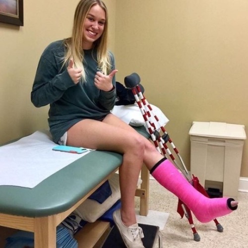 Happily casted - she looks pleased with the fresh cast on her broken ankle.