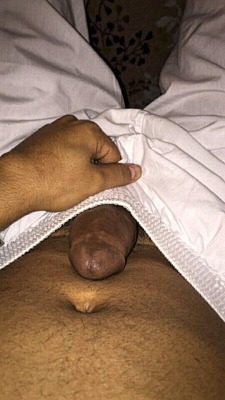 A cock shaped through a teen circumcision