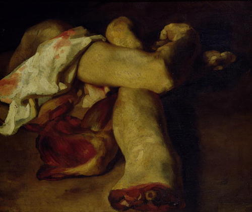 soulvacancy:Anatomical Pieces. 1819 - Theodore Gericault 