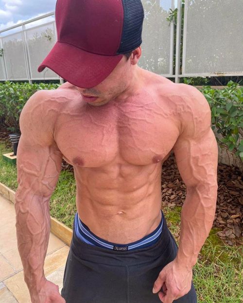 24 yo vascular IG: pedrovalenca6