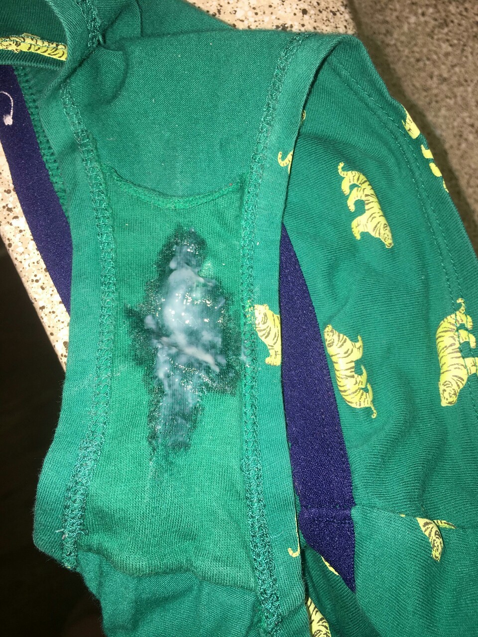 thecreamylife:  I have to say, I really love this set ! :) Vaginal discharge is sexy