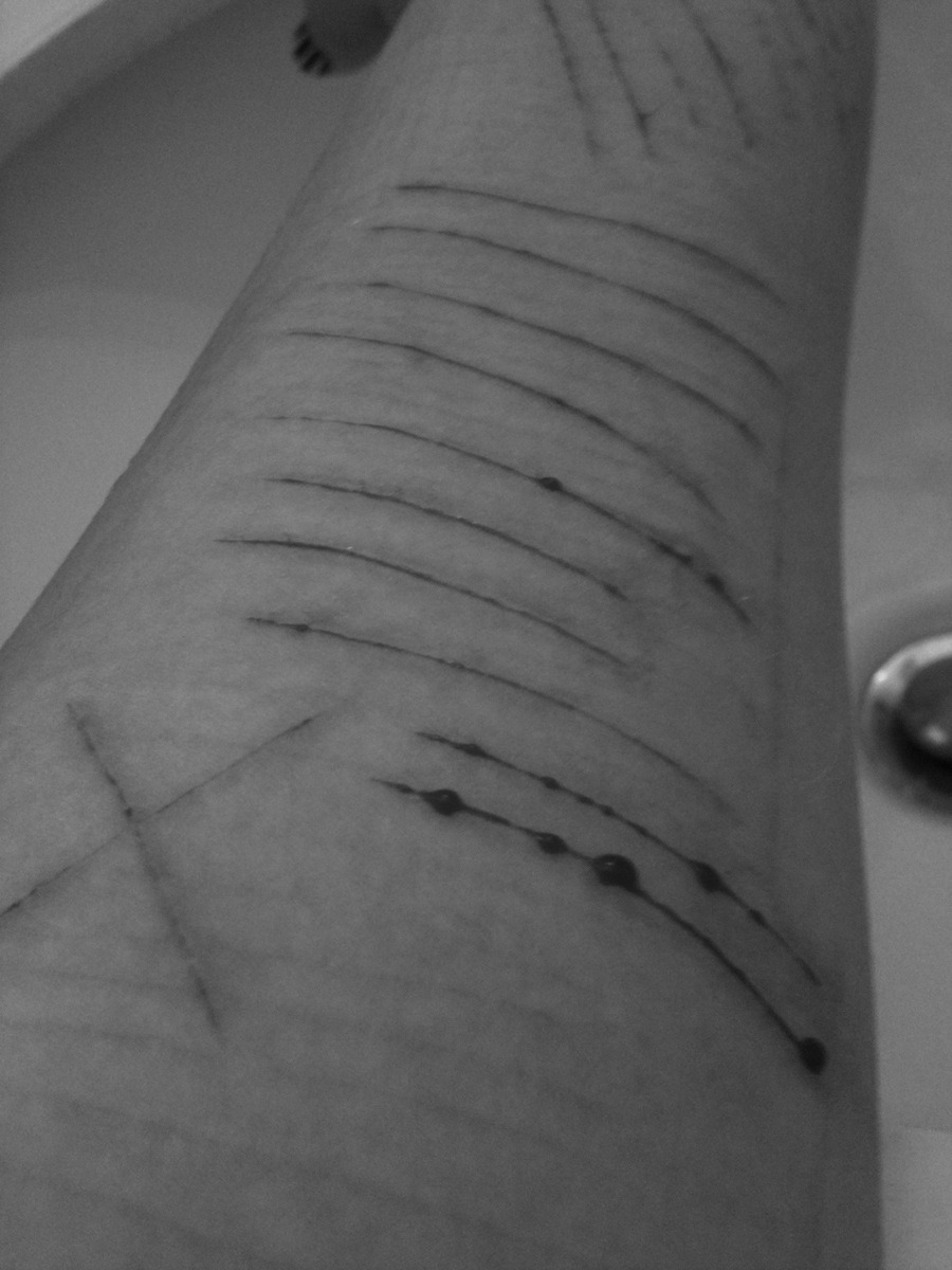 blaze-the-pain-away:  we-cant-all-be-strong:  I really am sorry.  get better xxxo
