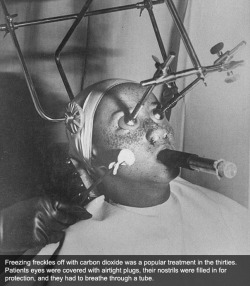 man-hatingcosmetologist:  official-sciencesideoftumbler:  alejo-alejo:  merisea:  How Beauty Procedures Looked In The 1930s-40s [x]  This is scary  The apple face thing tho   why was everything pre-1960 actually horrifying