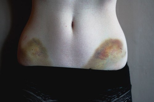 Pale Grunge Blood