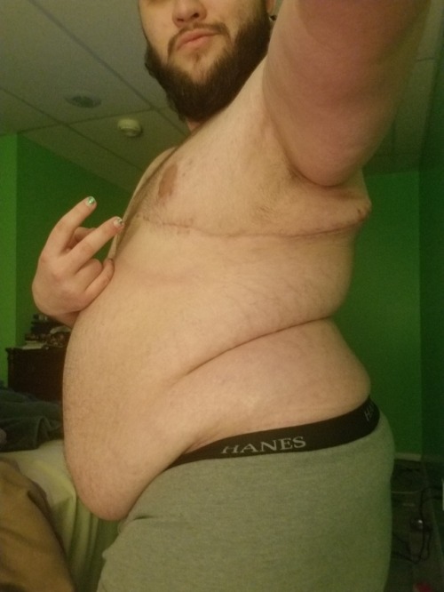 princesspunky96: ftmandgayaf: I love my trans, hairy, chubby body. And you should too ✌ I’m po