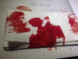 prettyblackblood:  Blood is beautiful.
