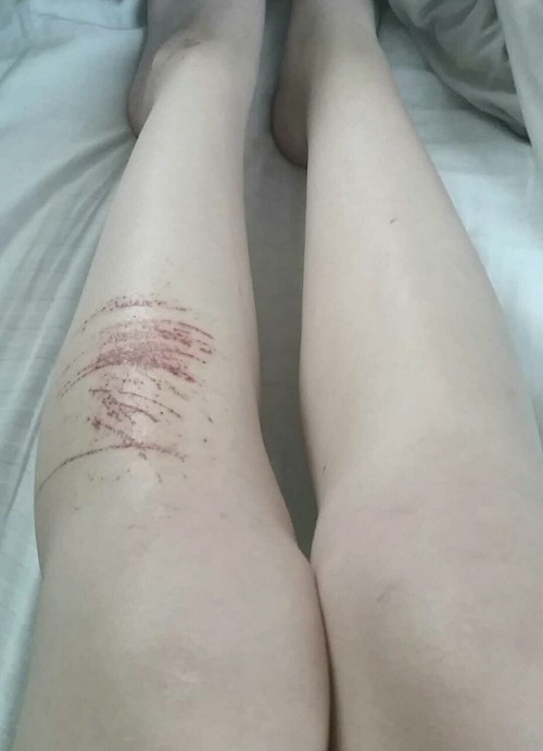 http://x014.tumblr.com/post/124642503524