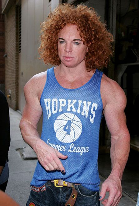 Stories Behind Fail Plastic Surgeries - The Odds