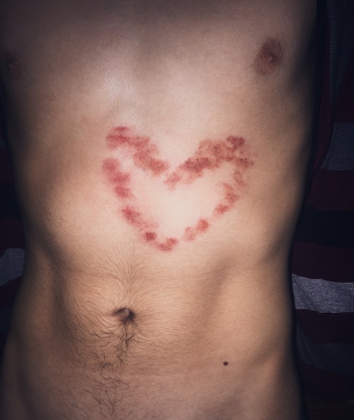 lovelycontusions:  took 30 minutes and it was worth it 