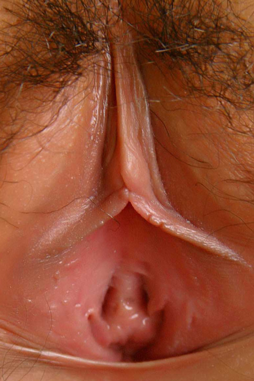 LabiaExposed