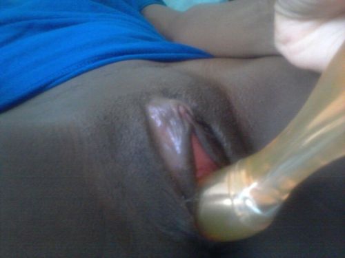 xlkyng10:  Pussy So Sweet. Look at that clit. 