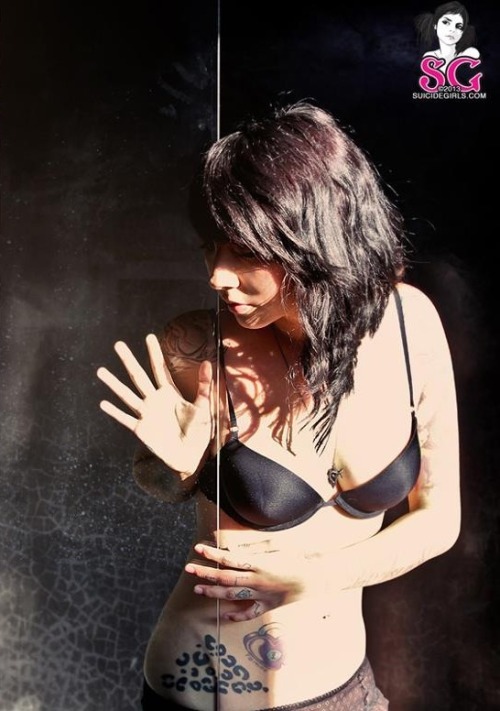  Bruise suicide 