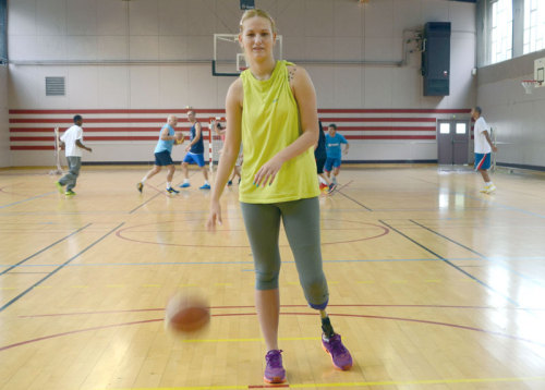 unusualpassions:  Basketball player lost leg in auto accident