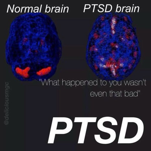 oldtoby90: bpmagazine: Just because you can’t see it doesn’t mean mental illness don&rsq