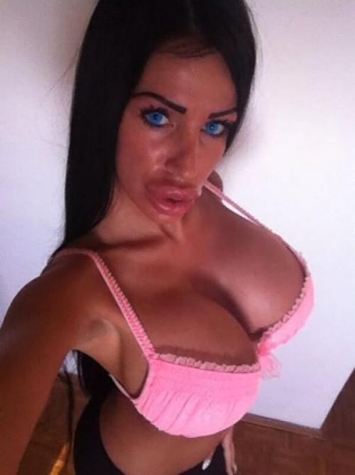 surgicallyenhancedfucktoys: bmboseeker: Permanent duckface Surgically Enhanced Fucktoys Disgusting b