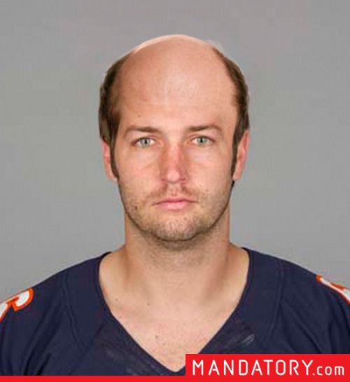 What if NFL QBs were bald