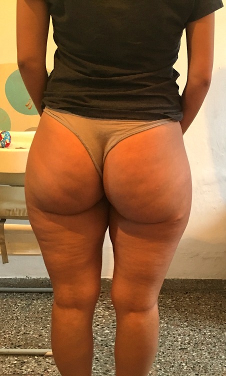 I love that cellulite