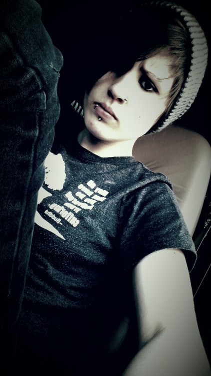 an-equinox: I’m breaking out, and I’m cranky.