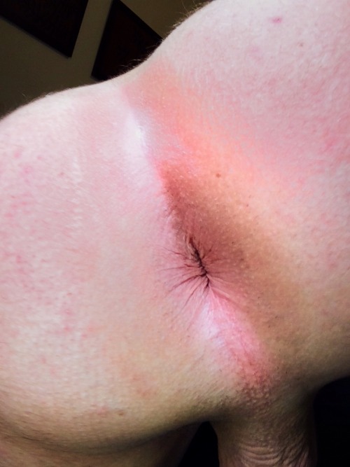 barebackboislut:  Close up of my boipussy! Who wants to dump their seed?