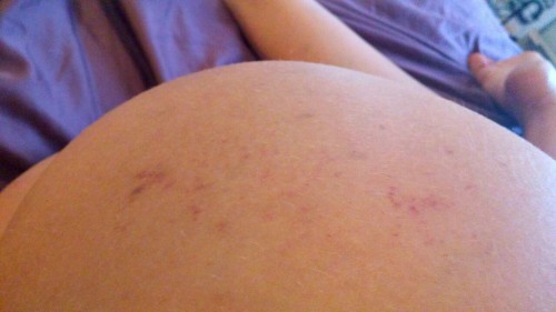 I like it when it stings and leaves a mark