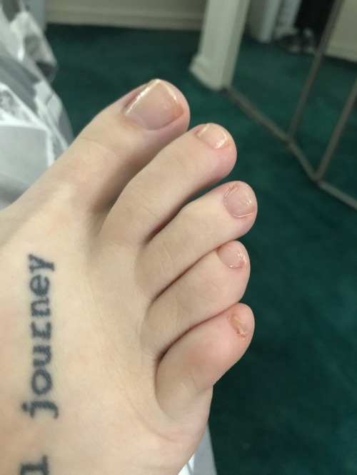 ohmysoles:Bare. It’s always refreshing to take off nail polish and give my feet some extra tlcohmyso