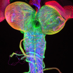 sciencenote:  Dr. Christian Klämbt and Dr. Imke Schmidt University of Münster, Münster, Germany Specimen: Beta-tubulin expression of a Drosophila third instar larval brain, with attached eye imaginal discs. Technique: Confocal microscopy  