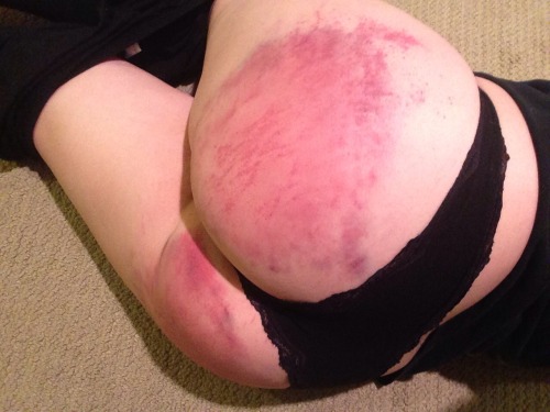 slide1mile6inches: So my butt got beaten pretty well tonight ^_^