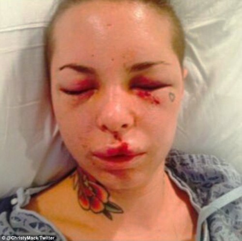 365daysofhorror:  PLEASE reblog this and get the word out. War Machine, an MMA fighter, allegedly brutally beat his ex-girlfriend Christy Mack. He broke 18 bones in her face, ruptured her liver, attempted to rape her, stabbed her with a knife and more.