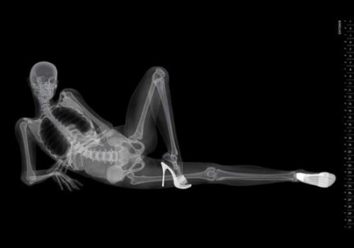 honey-dripped:  asgardreid:  spinesaw:  the-butt-prince-ike:  scienceisbeauty:  This is a classic `nude calendar´ when you extract everything which transparent to X-Rays, i.e. all the flesh, and therefore any remaining sensuality. Via Tha Mary Sue: “This