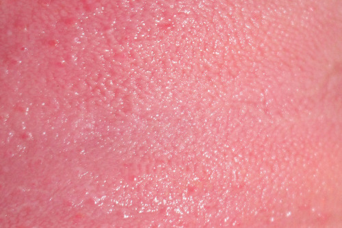 mesh3alxx.tumblr.com/post/115802798544/