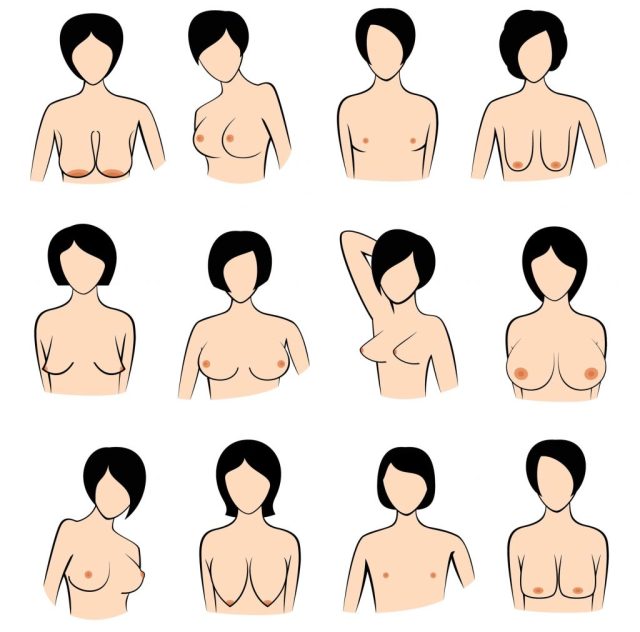 southerneclecticwitch:magpie-69:angelicbabydolll:Boobs aren’t circular. Boobs sag. Boobs can be lobsided. Boobs can be uneven. Boobs can be unsymmetrical. Boobs can have dry skin. Boobs can have stretch marks. Boobs can have spots. Boobs can be small.