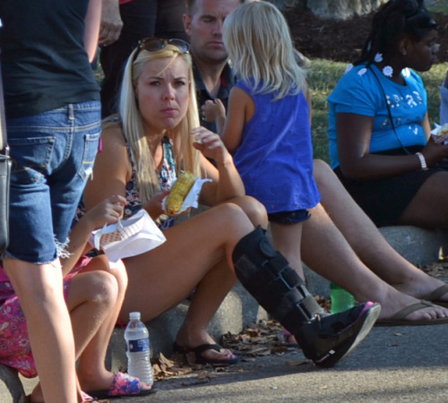 Three fair goers, one with a walking air cast, two with cam walkers.