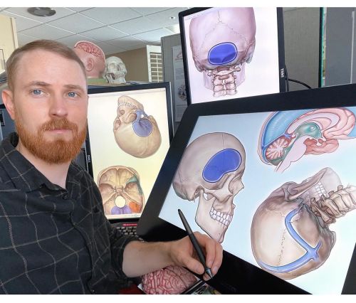 Adding to the skull/craniotomy collection ✍ #medicalartist #medicalillustrator #neuroplasticity #neu