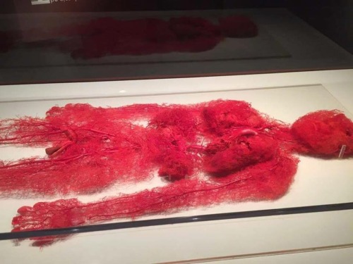 t4thc: slightlyusedcucumber: medicine-nerd: ladymasryah: radicalbundy: Blood vessels of a real p