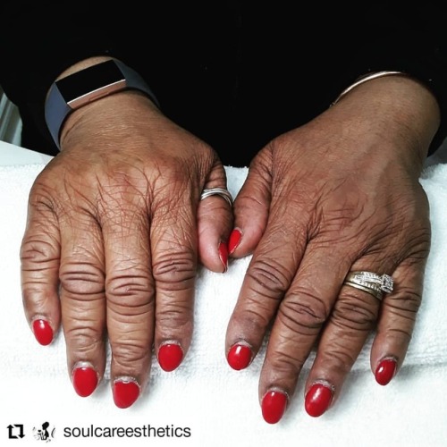 #Repost @soulcareesthetics BEFORE • • • • • • After 2 weeks, these Shellac Nails were ready for a f