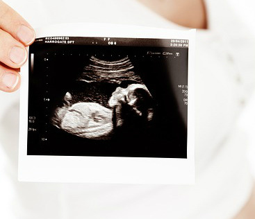 Every life matters —born and preborn. #prolife #praytoendabortion 