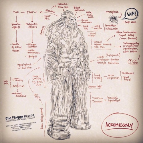 Acromegaly quick review. Dont forget to study the whole thing from real textbooks. #endocrinology #a