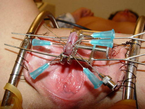 pussymodsgaloreBDSM pain games. Temporary mods. A photoset of 10 photos with one thing in common, clits are being pierced, mainly by needles, but also safety pins and a fish hook.Remember that piercing the clit can sever nerves and lead to a certain amoun