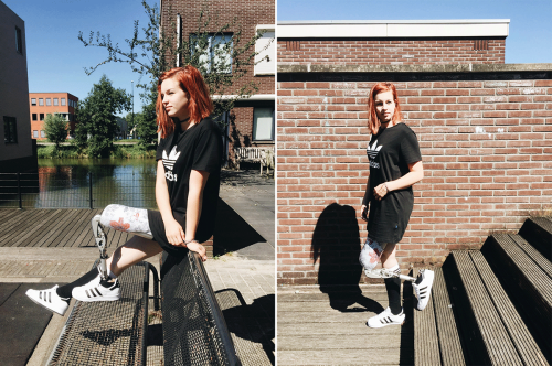 saramontgomerymodeling-blog: interdevo-devotee: Anputee girl in Adidas  Her prosthetic is cute af