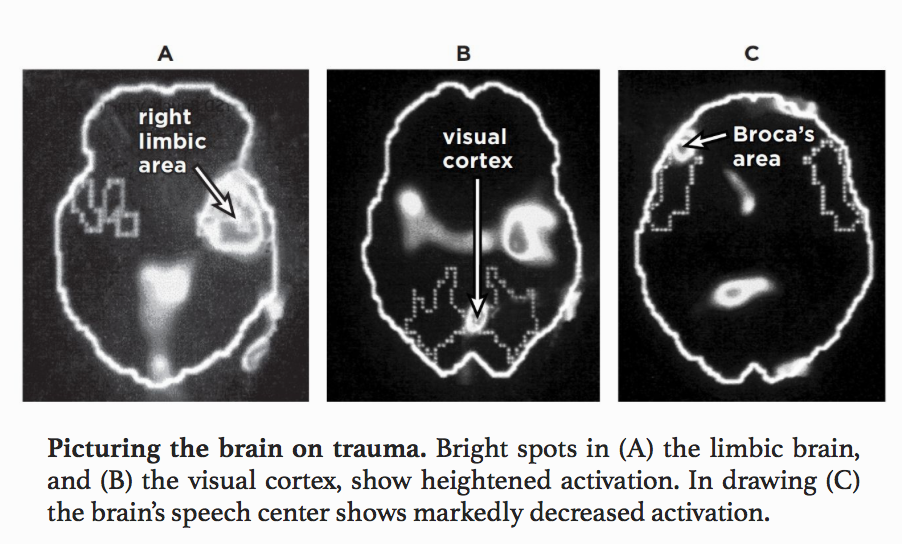 Depression &amp; Mental Illness Resource Blog — arterialtrees: After all eight  participants...