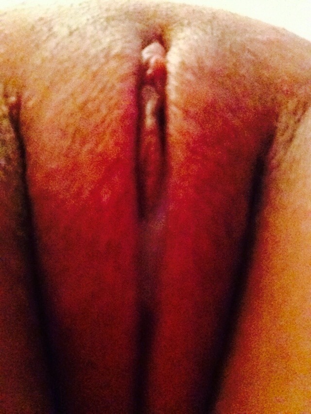 xxxnaughtykitty:  Getting ready to be fucked. I’m so swollen right now…