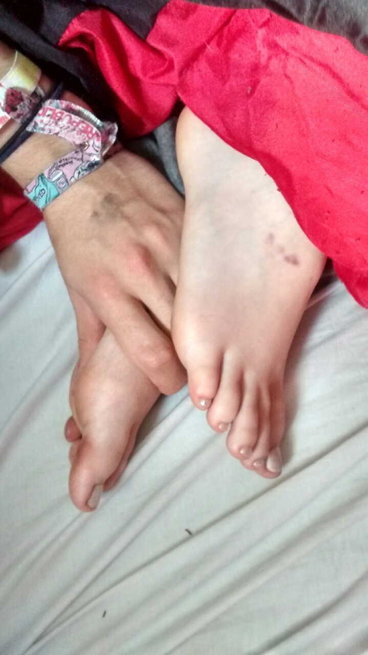 ashfeet:  Ash’s sleepy feet are very poorly and sore after our night out last night