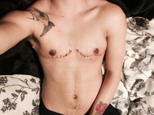 scumbugg: theuntetheredsoul: scumbugg: first full pics of my chest. I am amazed. I’m so so so 